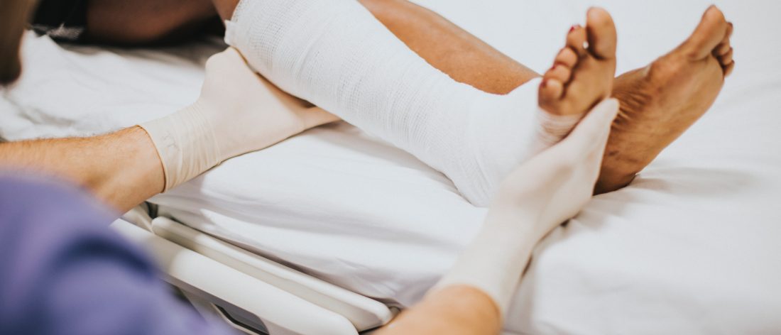 Fractured leg